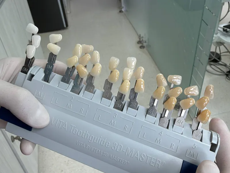 Guía de color dental VITA 3D-Master en manos con guantes, en el consultorio